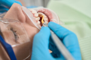 Dentist performing procedure on patient's teeth.