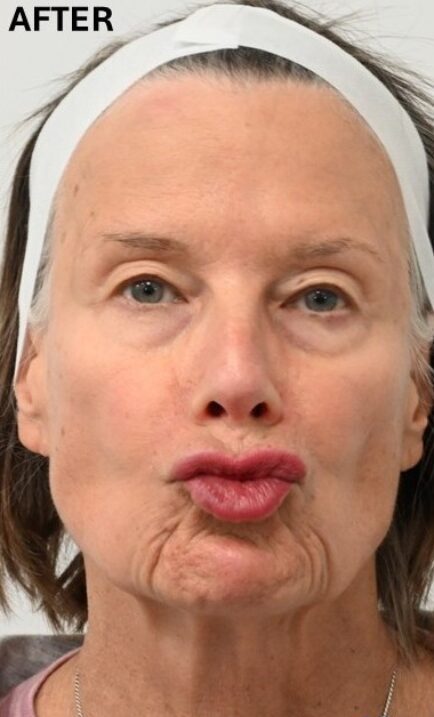 Older woman making a kissy face with puckered lips.