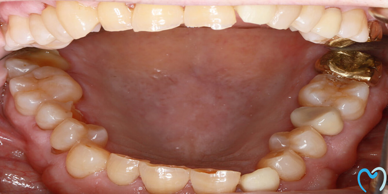 Close-up of the inside of an open mouth showing the tongue and teeth.