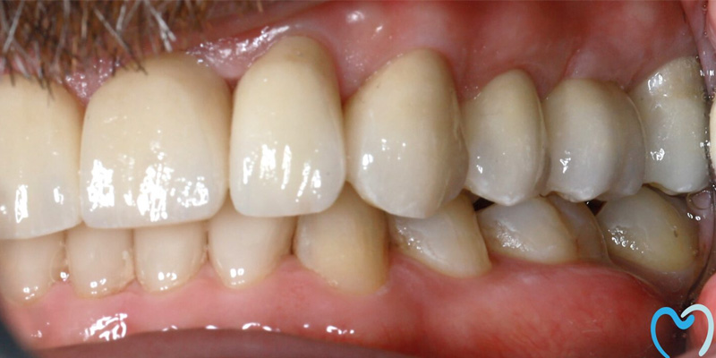 Close-up of healthy human teeth and gums.