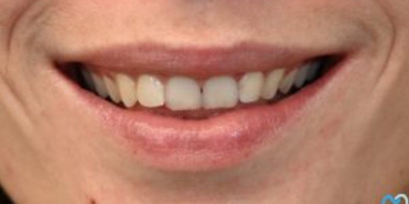 Close-up of a smiling mouth with teeth and lips.