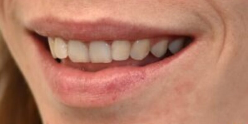 Close-up of a smiling mouth showing teeth and lips.