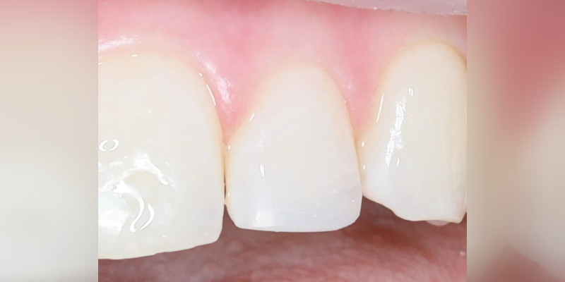 Close-up of healthy human teeth and gums.