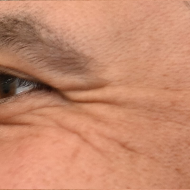 Close-up of eye wrinkles and skin texture.