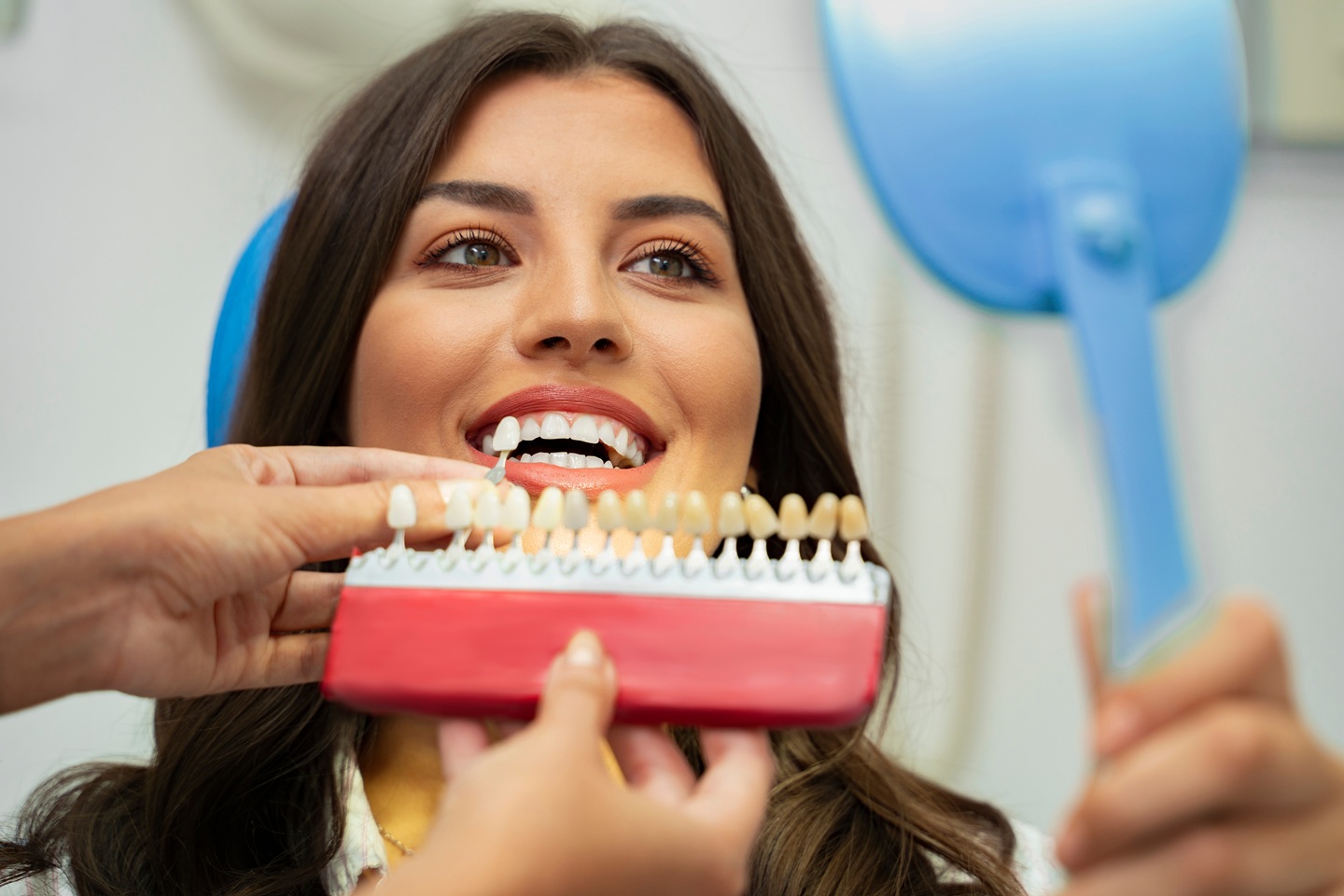 What to Expect During Your Veneer Procedure