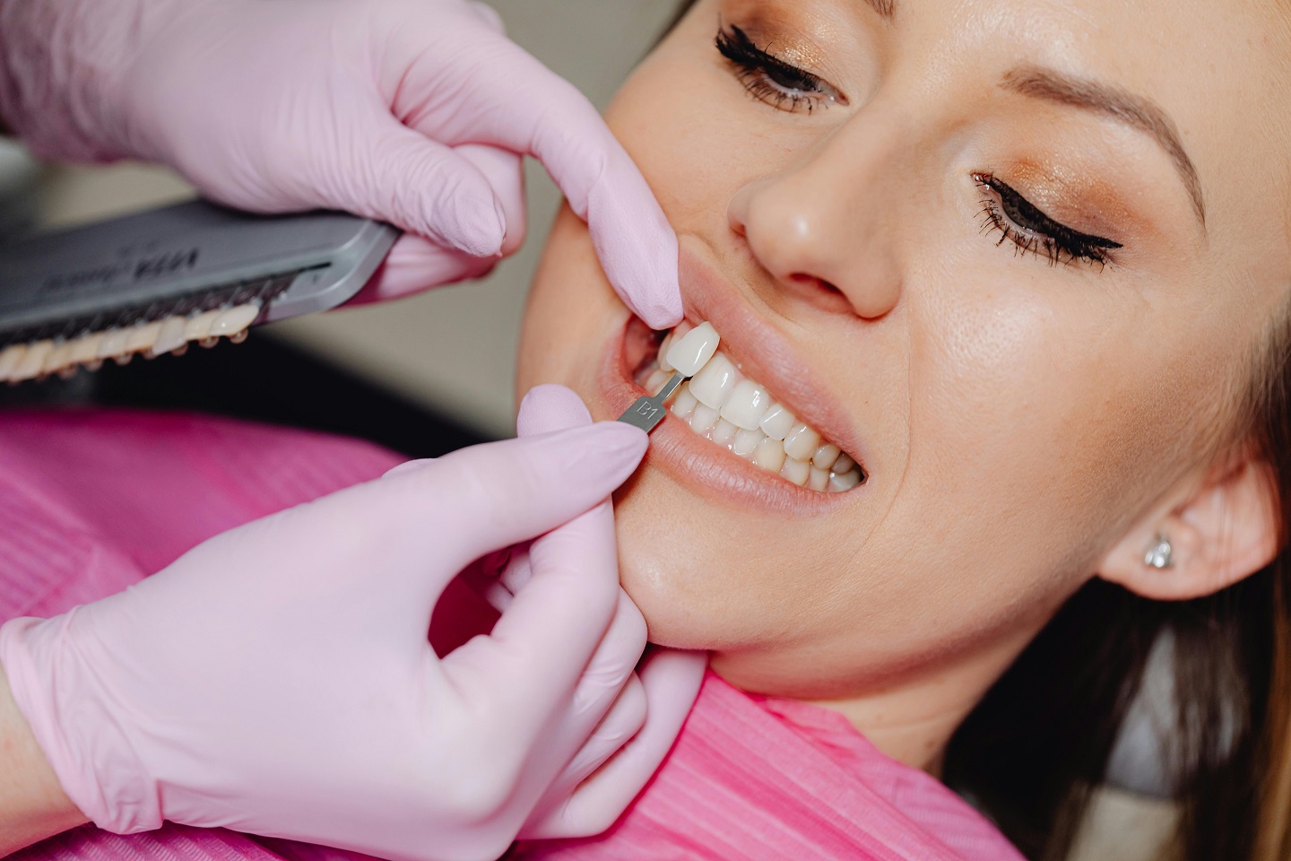 How Long Do Veneers Last? Care & Maintenance Tips