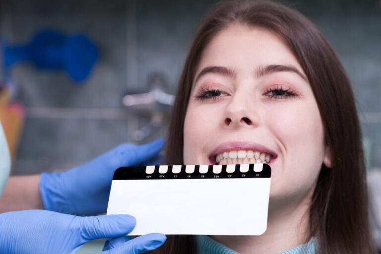 Are Veneers Right for Me? Candidacy Guide