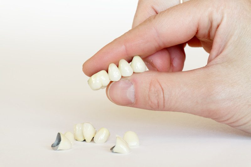 Transform Your Smile with Porcelain Crowns